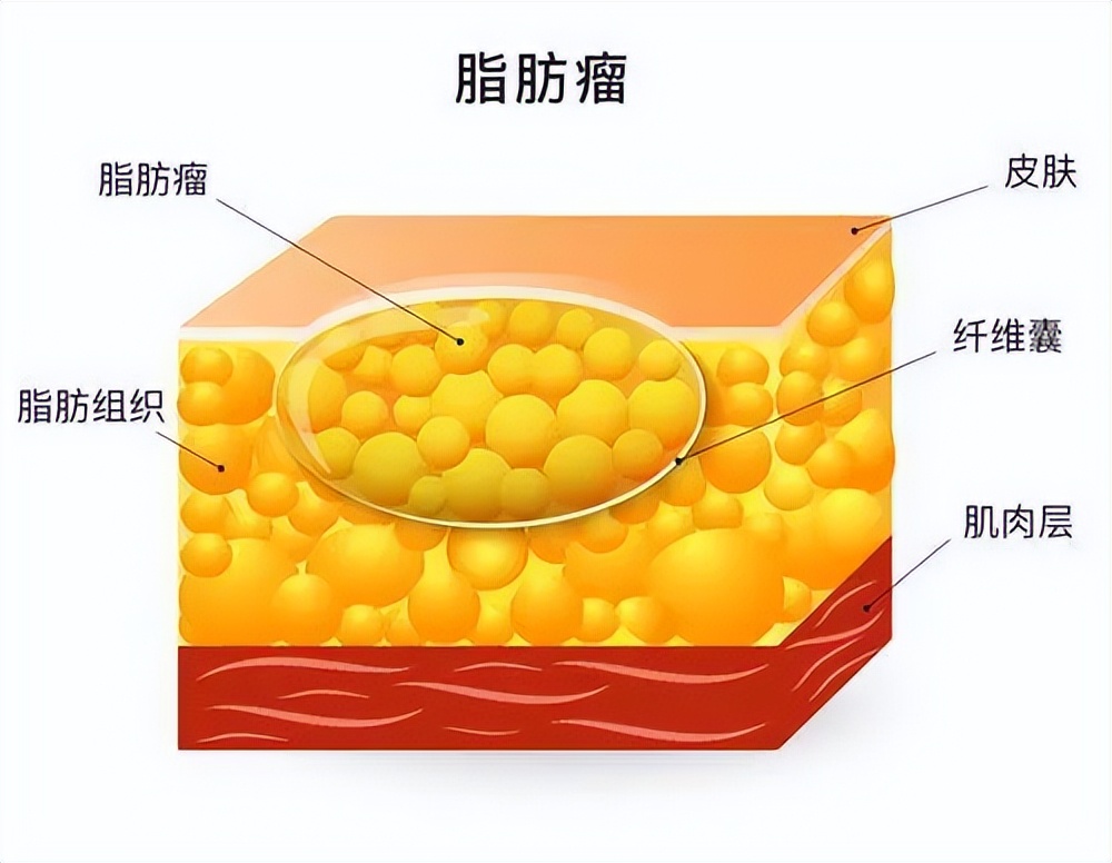 人體內都有一種致瘤的基因叫做