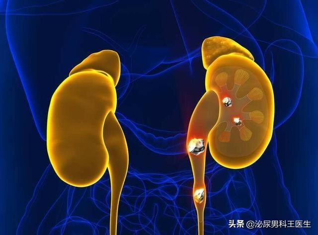 什么是碱性食品（3种碱性食物对排出尿酸有利）