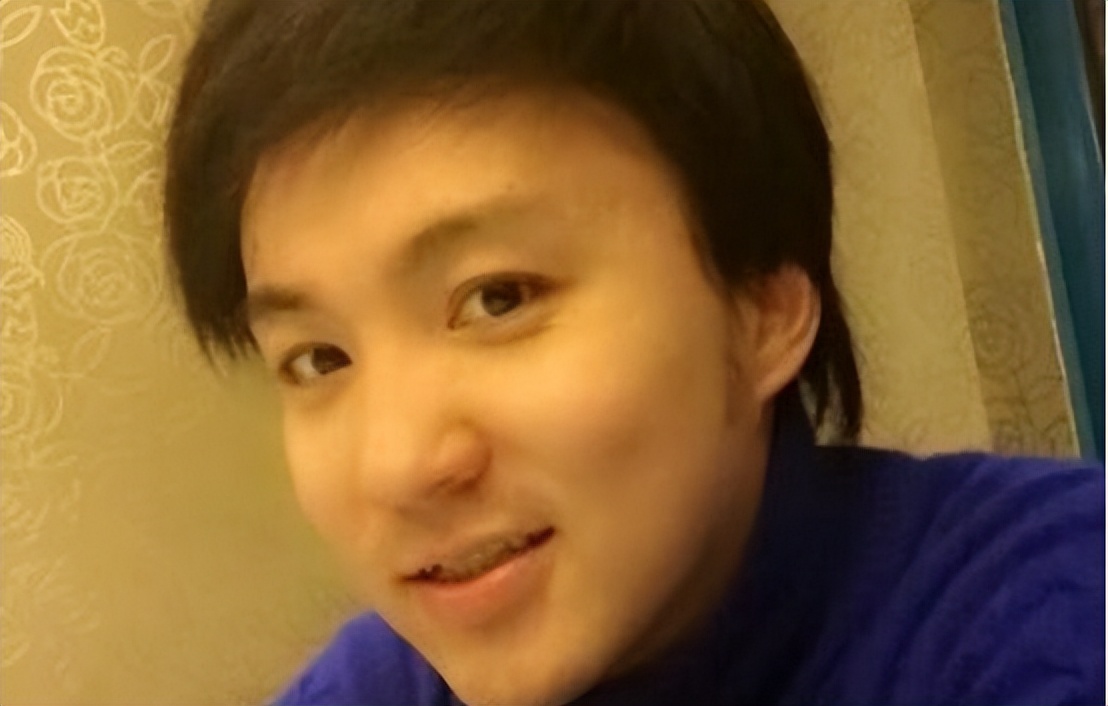 因饰演三毛爆红，14岁秃顶植发挨300多针，童星孟智超怎么消失了