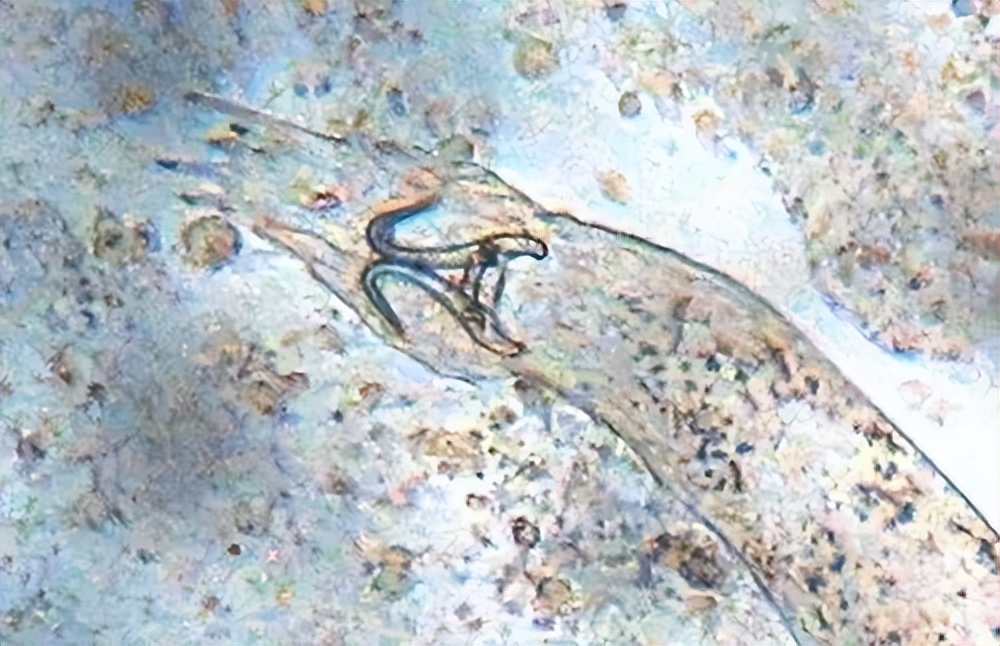泥鳅常见的寄生虫病是三代虫病，该如何防治？
