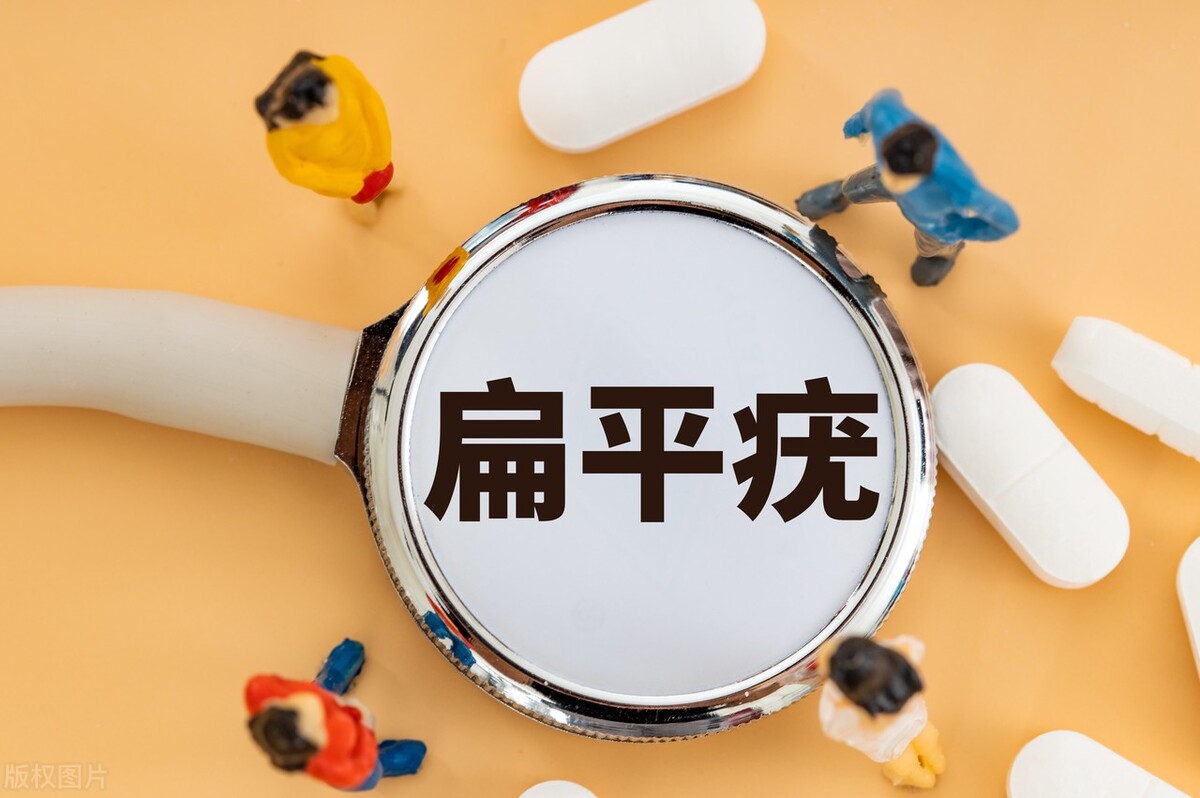 扁平疣的治疗 扁平疣去除最好药膏-春风号