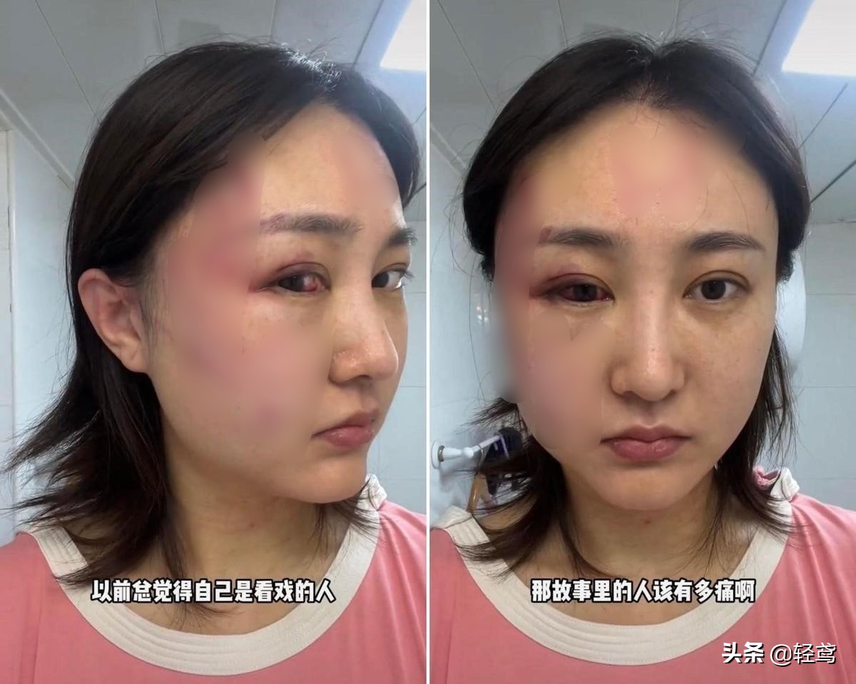百萬粉絲網紅控訴遭家暴被打到瀕死 老公怒反擊：她先出軌