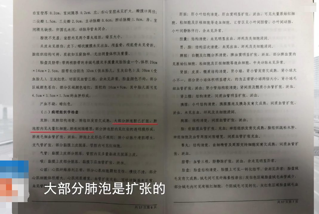 一孕妇怀双胞胎5个多月流产，家人认为是医院害死了孩子，医院：流产的是妊娠物，不是人