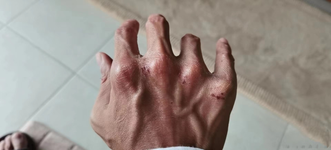 这7位明星，都因拍戏受重伤，留下“后遗症”，一个比一个严重