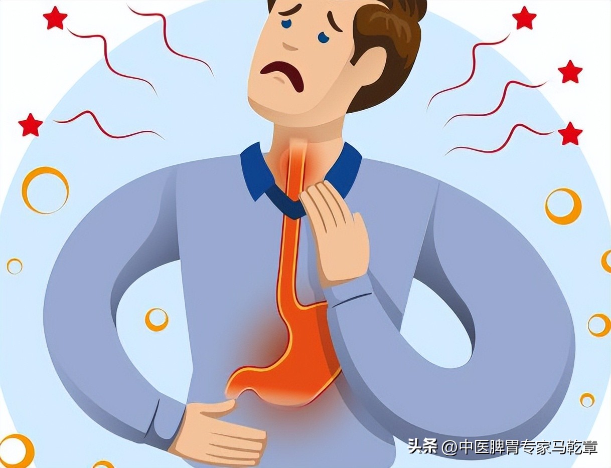 反流性食管炎的症状 食道炎的早期症状