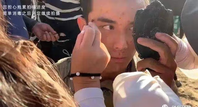 杨幂的眼角，阿娇的脸，明星脸上受伤、毁容，各个让人揪心