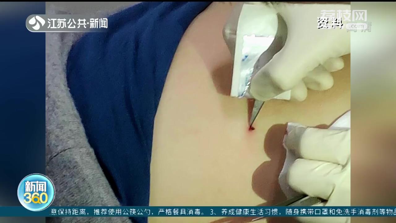 5月蜱虫出没季，当心！叮咬出现神志不清等重症表现