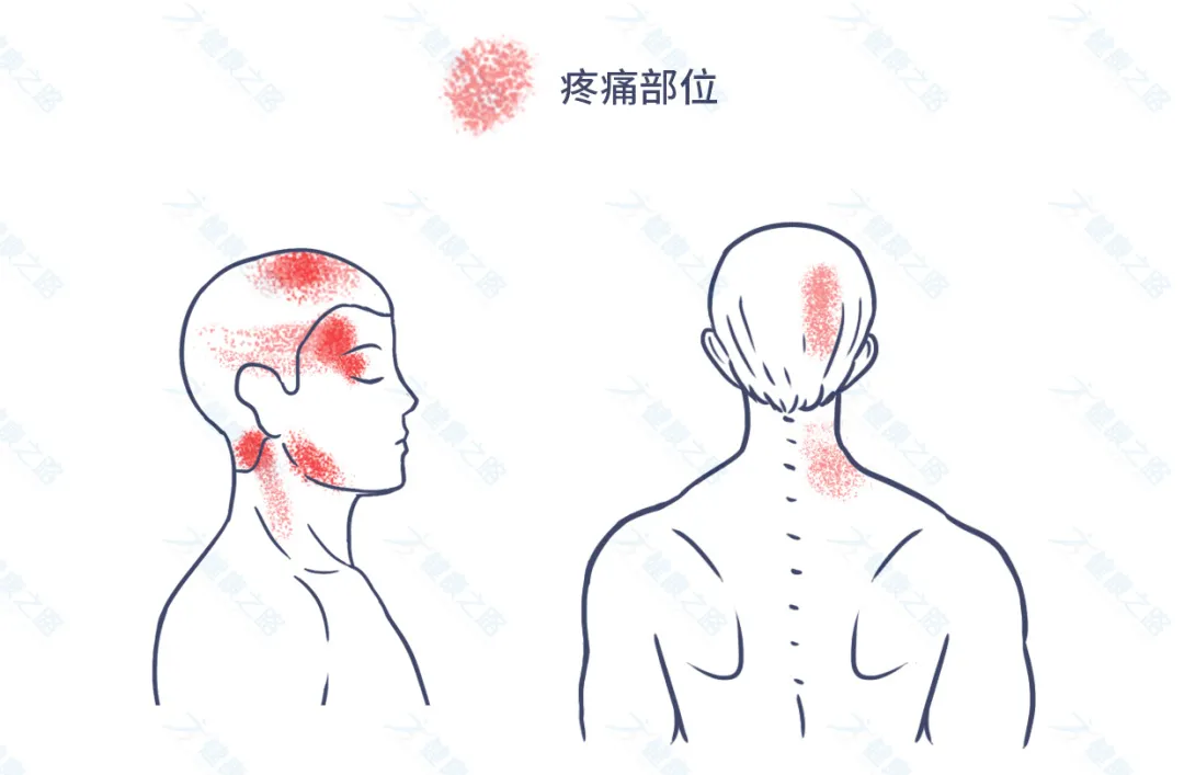 1个马上缓解头痛的方法，简单有效，还能预防颈椎病
