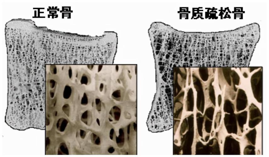 老人经常喝牛奶与不喝牛奶，差别大吗？医生告诉您实情