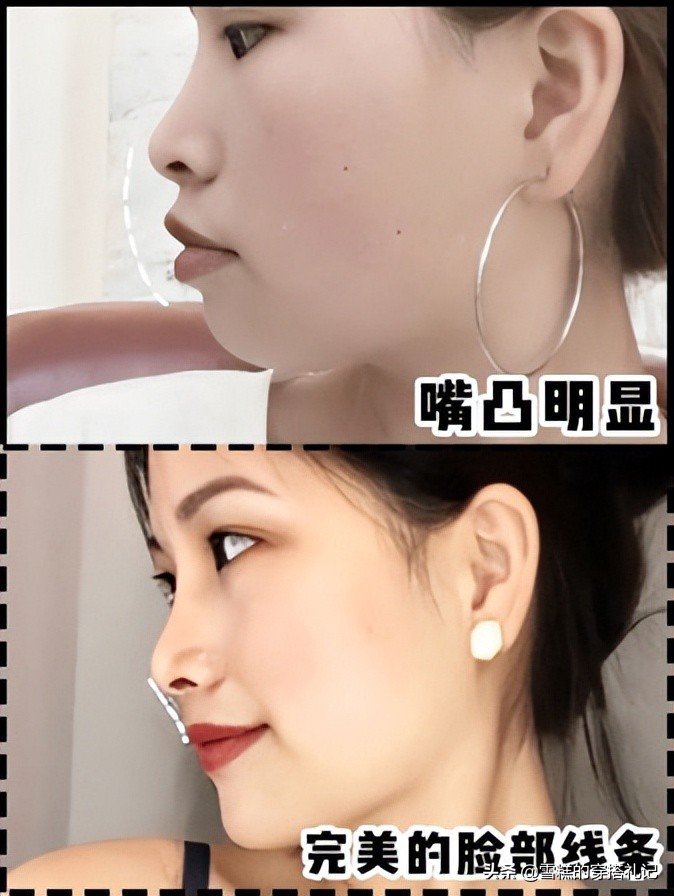 方脸、圆脸都不算什么，“扁平脸”才可怕！形象颜值还很难拯救