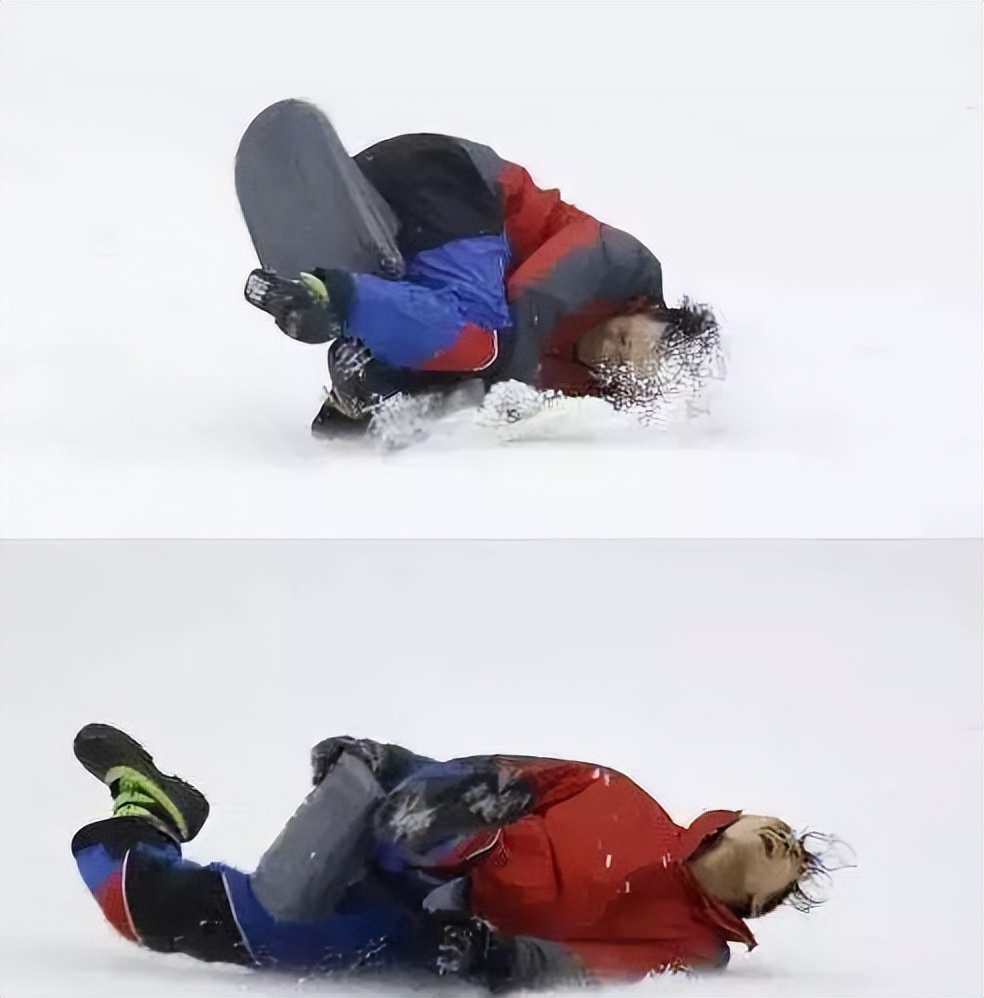 杨幂新综眼角受伤险毁容!王宝强摔断腿李晨缝22针,