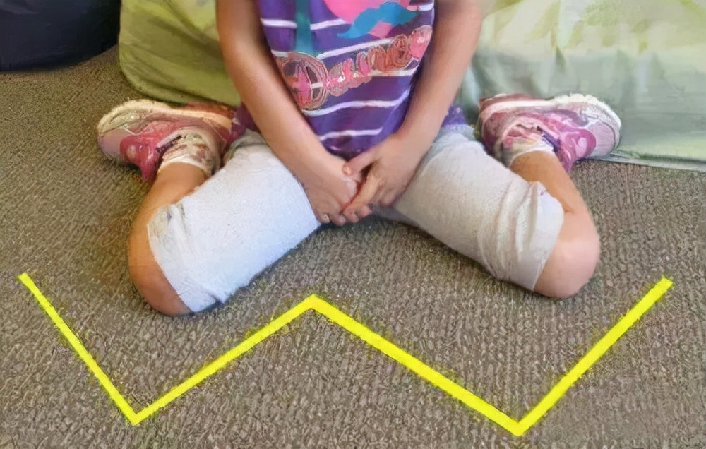 给新生儿绑腿的原因或许老人想错了,怎样让宝宝腿型漂亮,要记牢