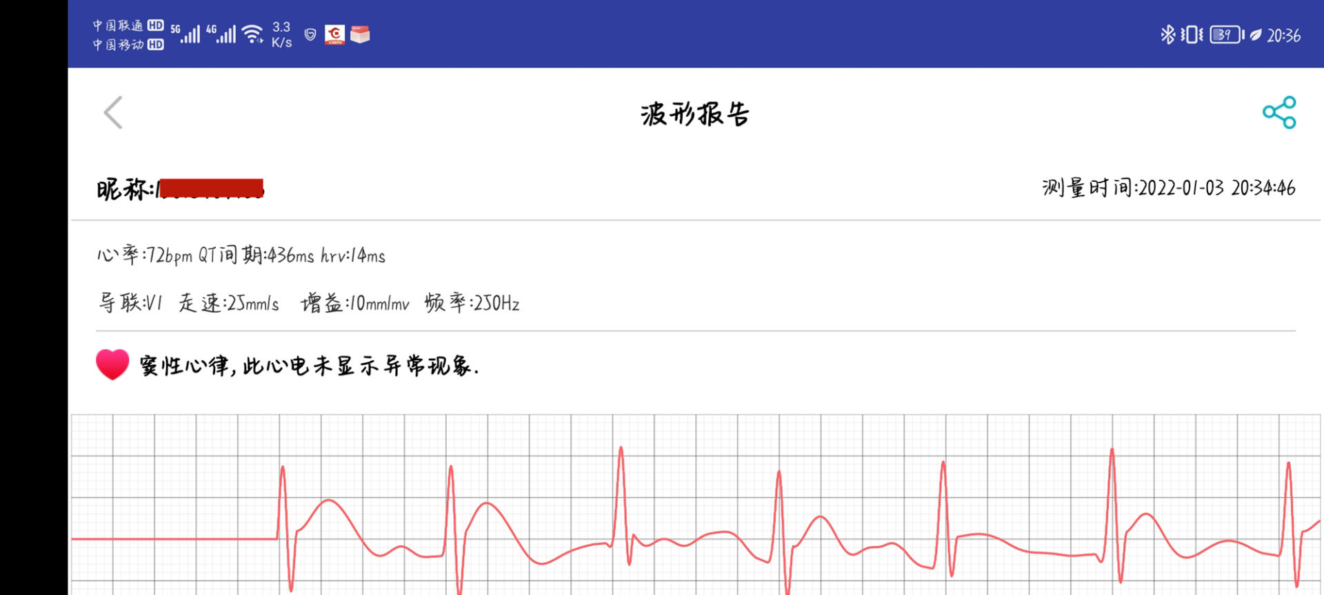 dido y2手環深度測評,不到400能進行血壓心率監測,太強了