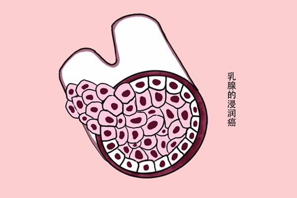 若女生坚持白天不穿“内衣”，一年后，身体会发生什么变化？
