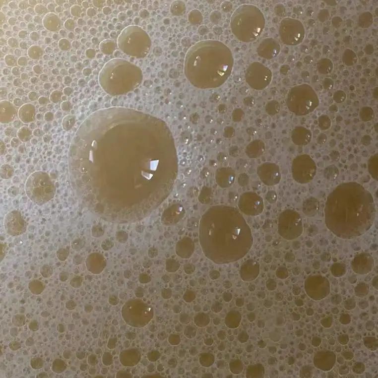 细菌性阴炎的症状图片(这些白带都算异常) - 赤虎壹号