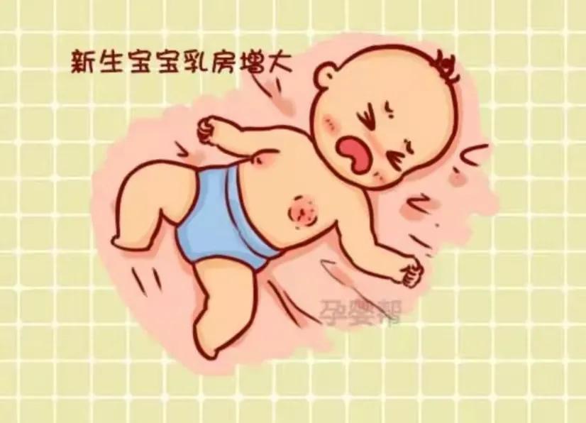 乳腺肿大,假月经: 男女新生儿均可发生乳腺肿大,在出生后的3~5天可能