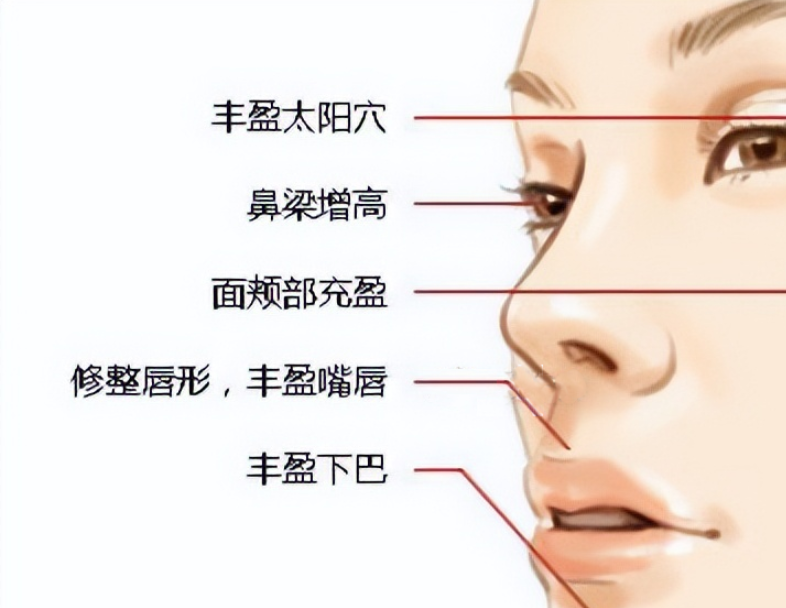 面部填充材料都有什么？哪种效果自然啊？术后多久能恢复？