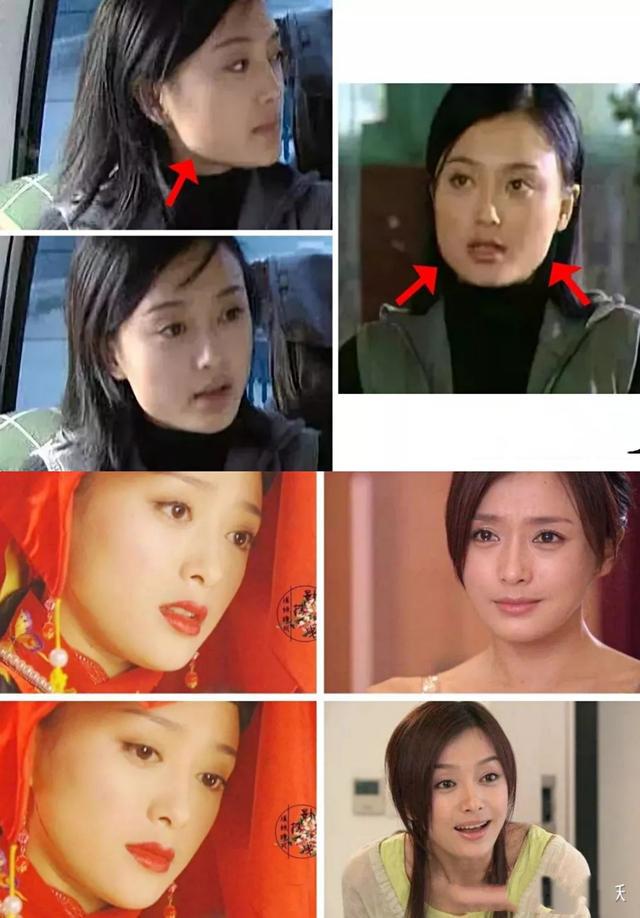 美人的脸却败在鼻子上?这9位女星鼻子好突兀,太可惜