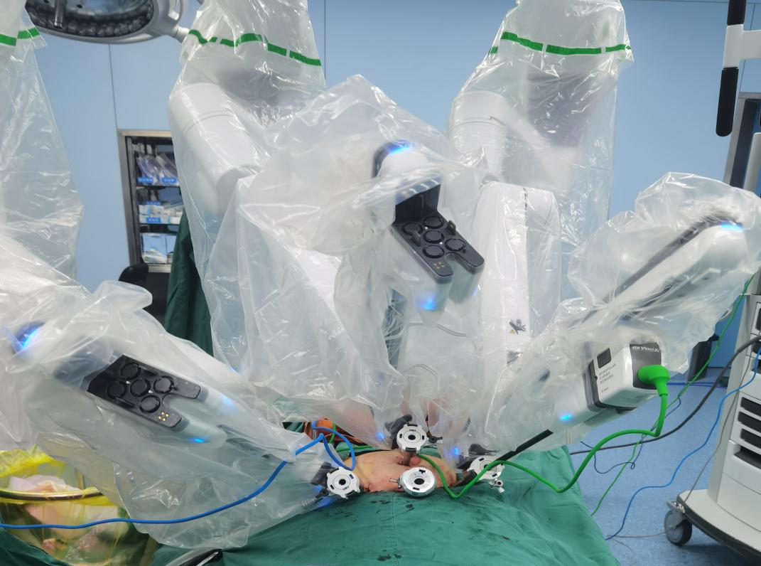 仁医新术| 江西省人民医院首创机器人腹腔镜下经腹膜外入路“三臂法”前列腺癌根治术