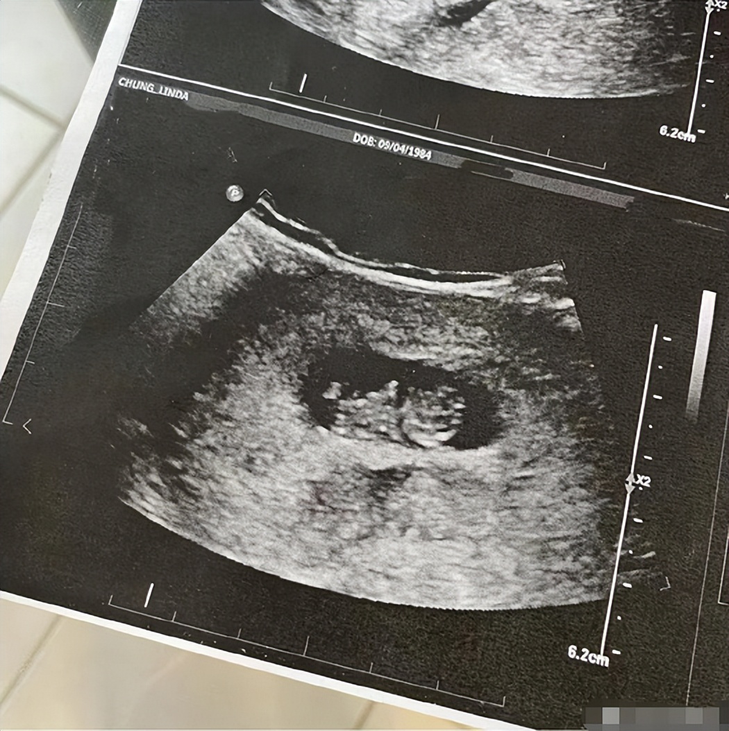 38岁女星钟嘉欣官宣三胎！穿紧身衣小腹隆起明显，晒三胎B超照