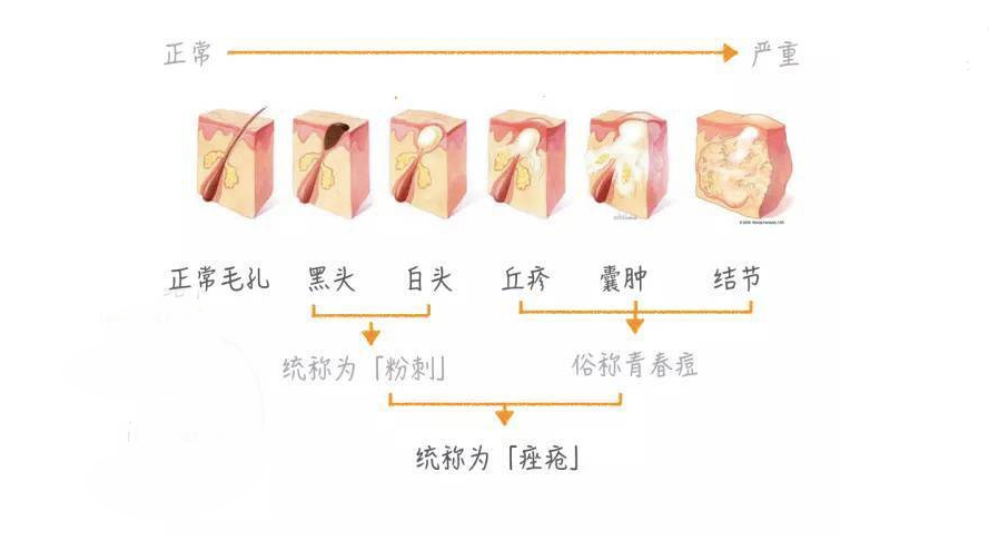 婴儿脸上有黑头（脸上的）