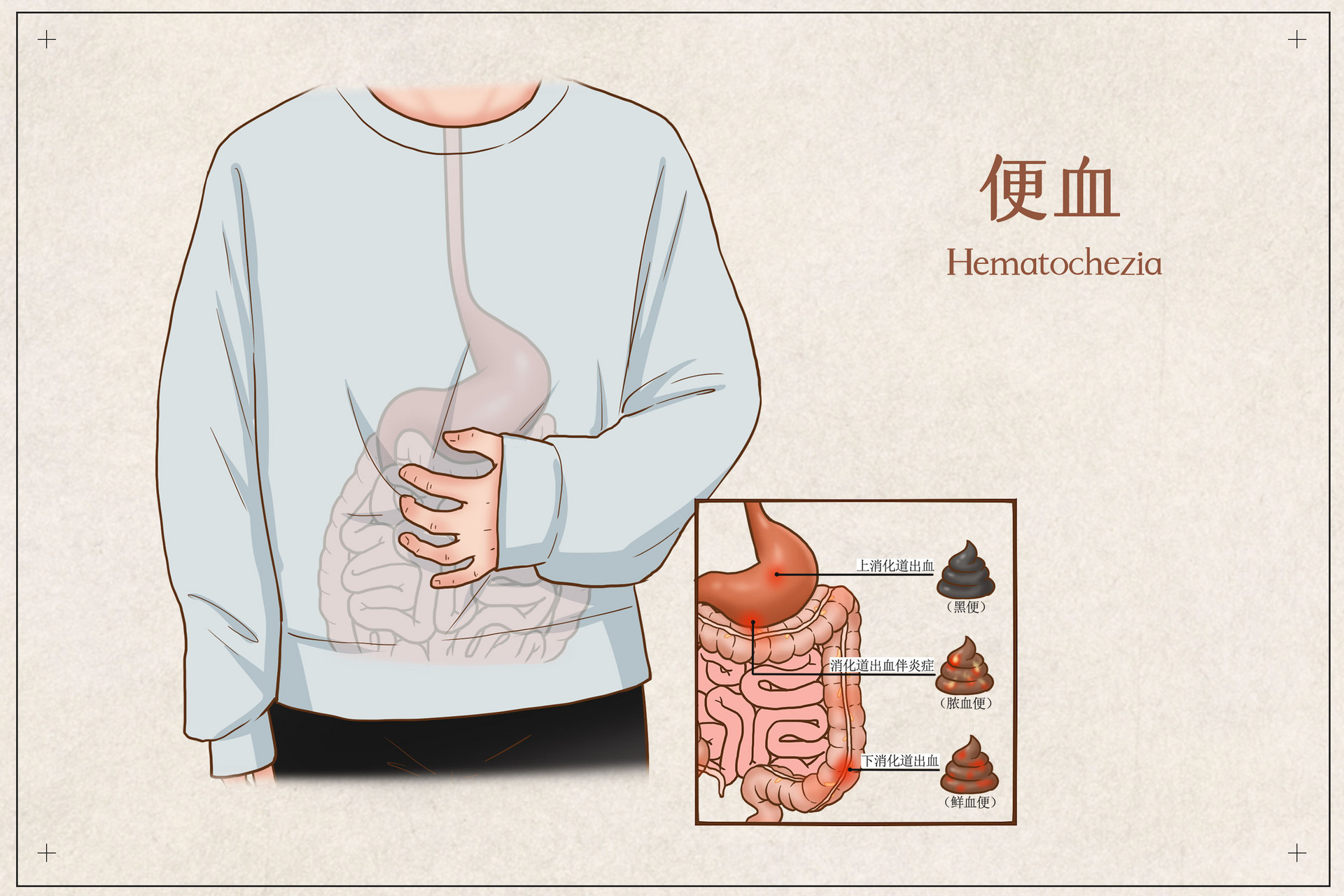 拉肚子拉出血怎么缓解,大便拉出来血是怎么回事-友友