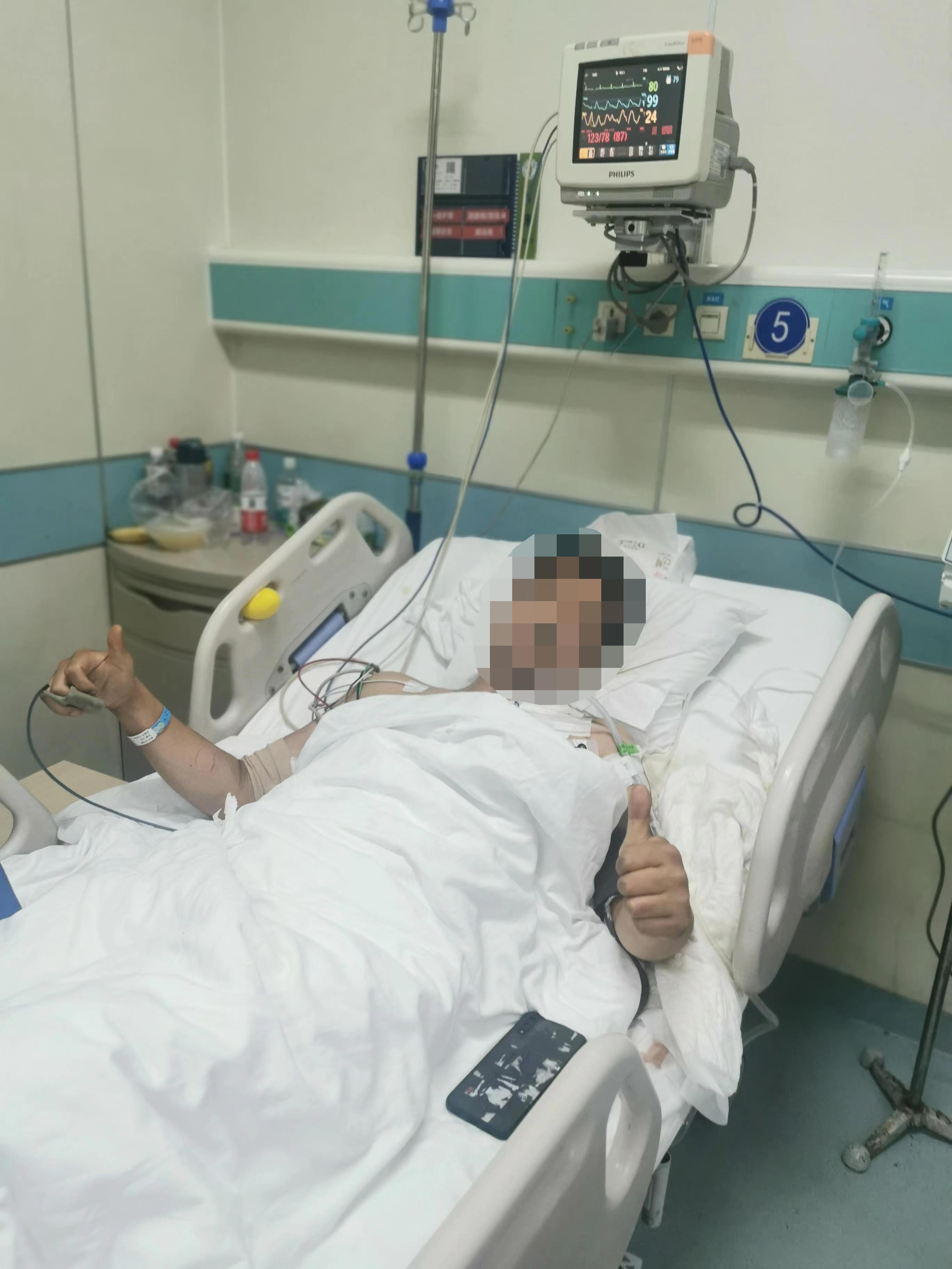 5吨玻璃砸伤 严重张力性气胸生命垂危 急诊科紧急抢救