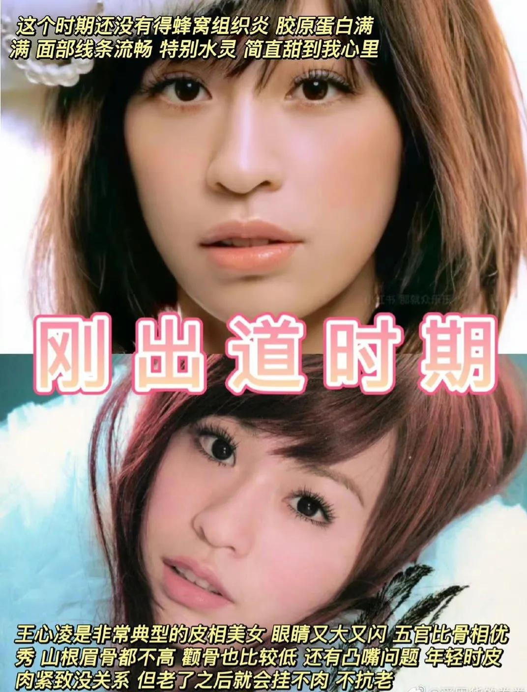 甜心教主“王心凌”的脸究竟经历了什么