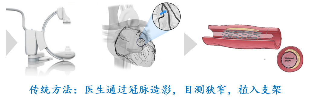 欧洲医疗盛会聚焦，中国原创技术可为医保节省数十亿