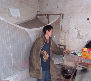 湖南44岁男子手脚长满木疙瘩，村医束手无策，医生说出了真相