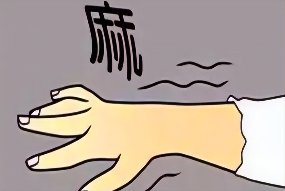 颈椎病还能导致瘫痪吗？颈椎不好的人，这些症状要注意