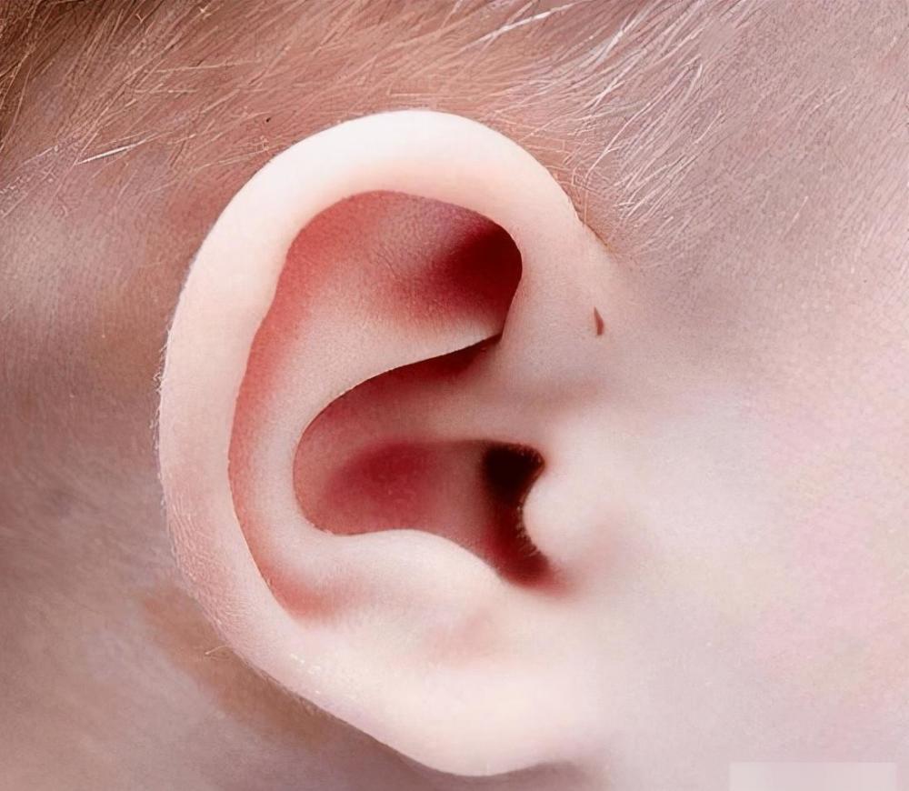 外耳廓图片（外耳轮廓图片）-第1张图片
