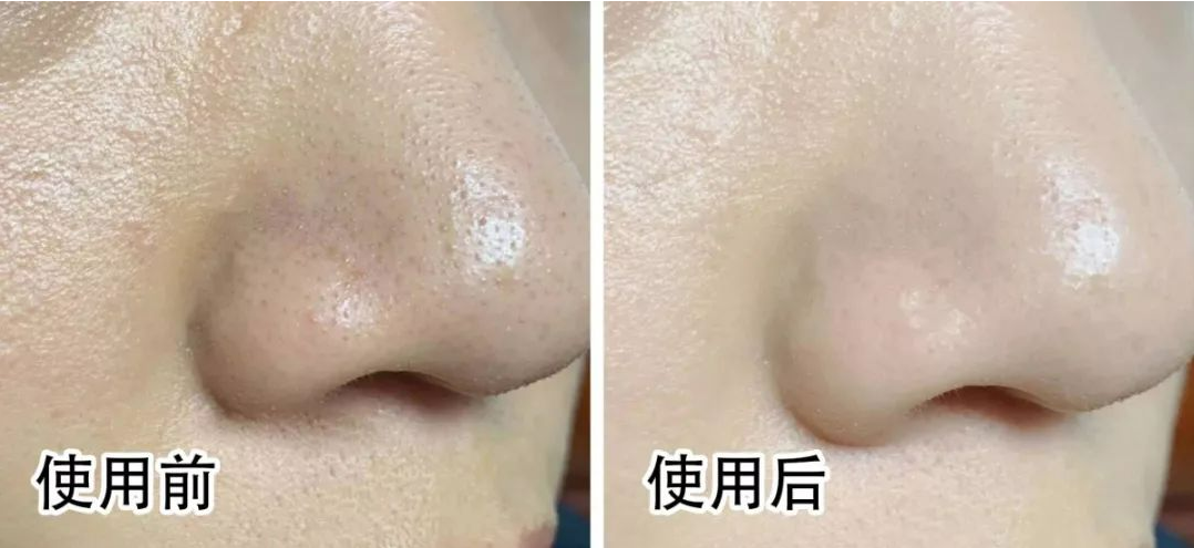 让皮肤变好的从来都不是护肤品，而是护肤方式