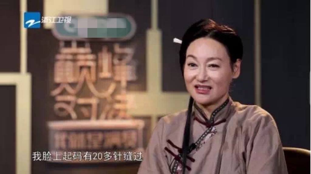 影帝影后多敬业？有人生吞12枚鸡蛋、鼻子被打歪，有人为戏锯门牙