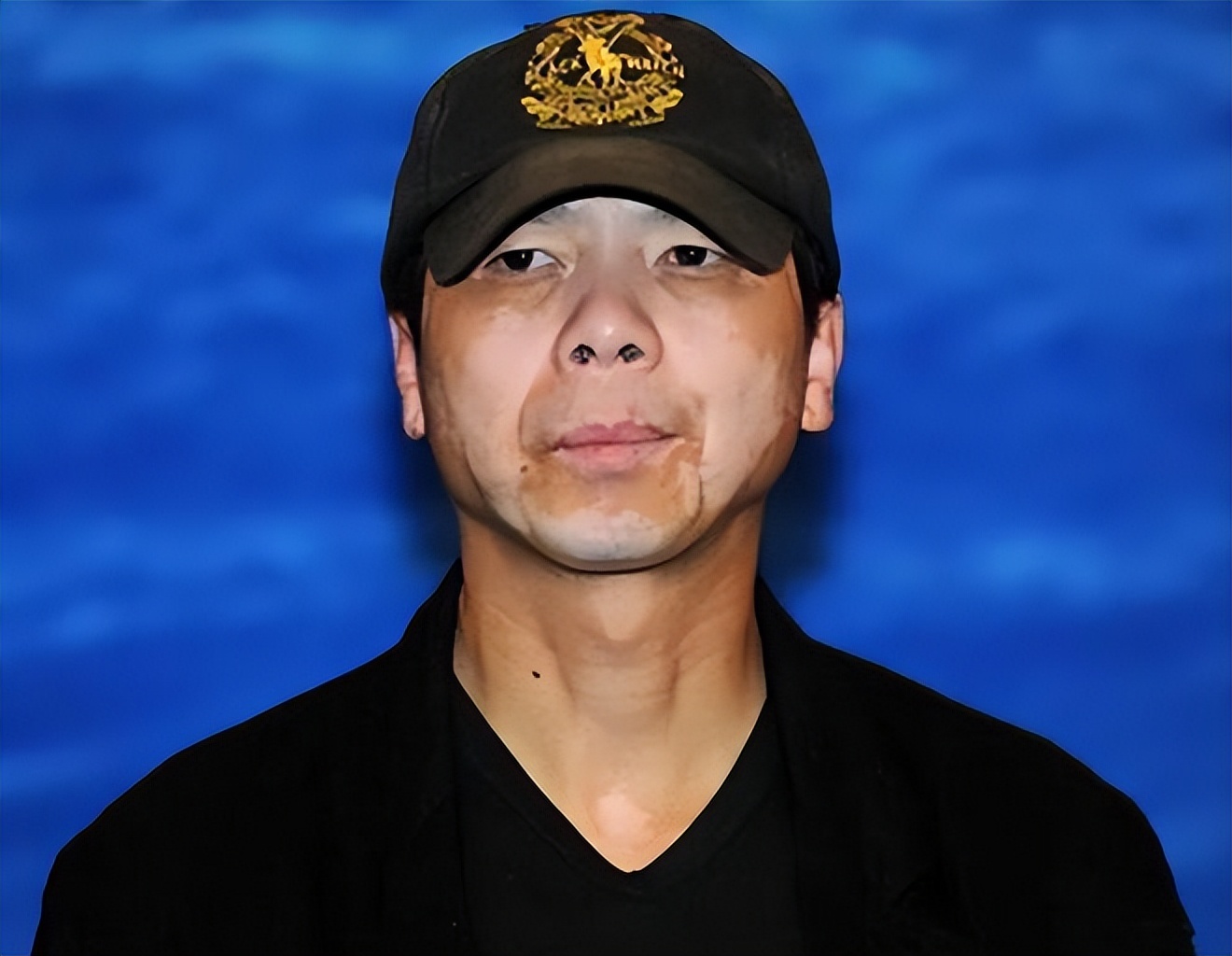 “被顽疾缠身”的7位明星，明明一个比一个有钱，却依旧饱受折磨