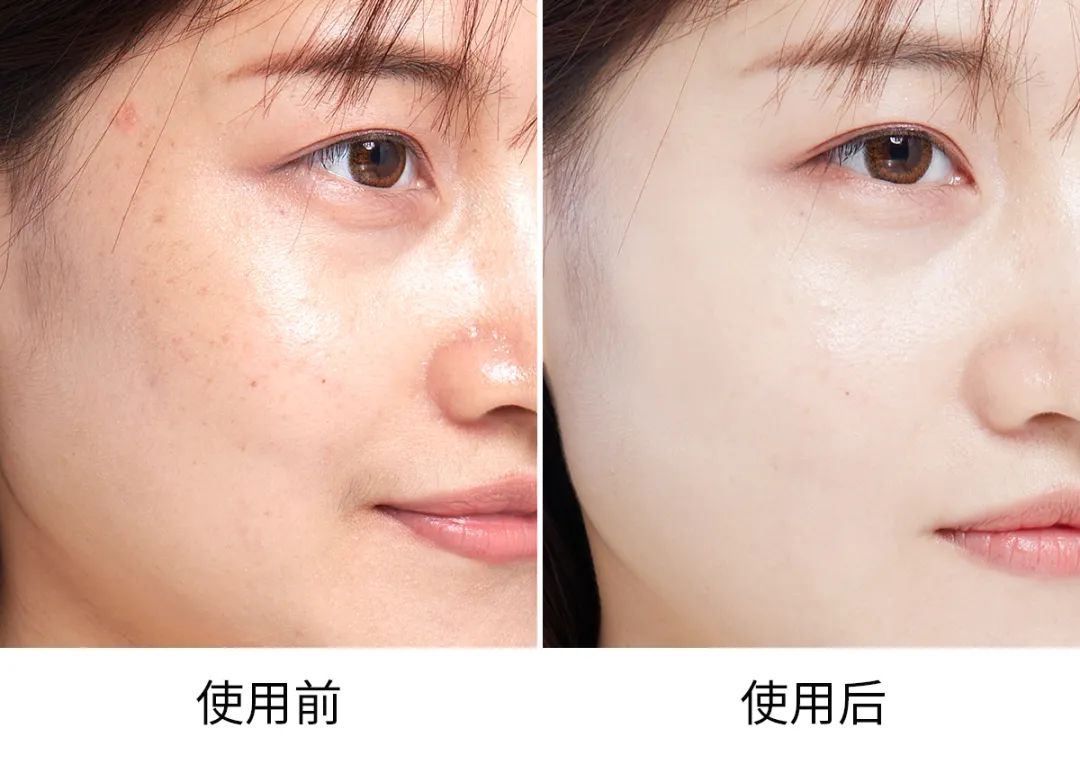 玉蘭油美白祛斑套裝（olay玉蘭油美白套盒，超平價(jià)的美白補(bǔ)水系列！）