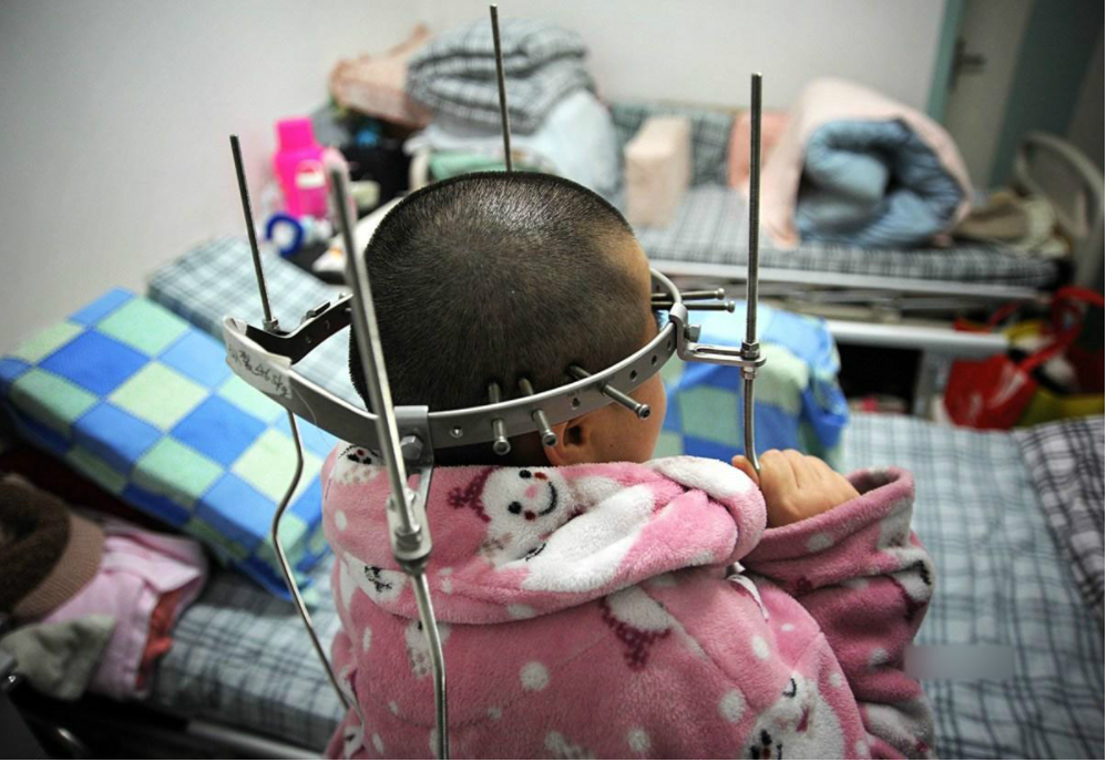 "天线宝宝"们穿戴的支架到底是什么?