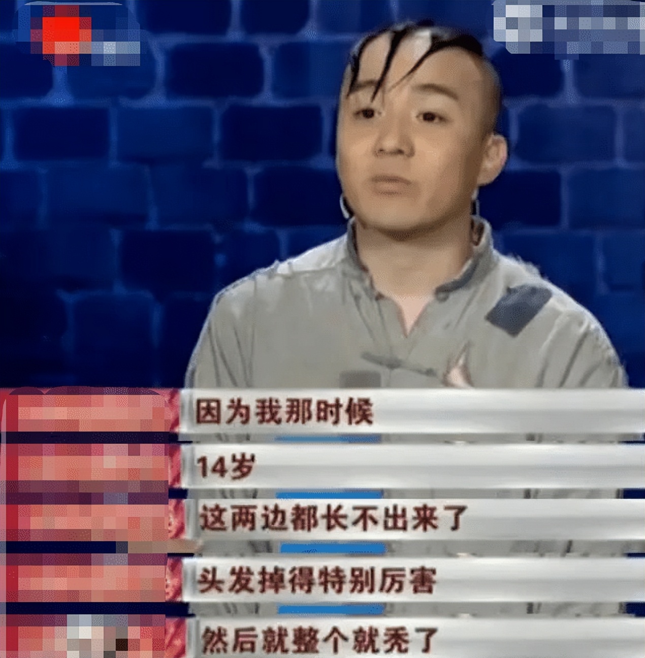 因饰演三毛爆红，14岁秃顶植发挨300多针，童星孟智超怎么消失了