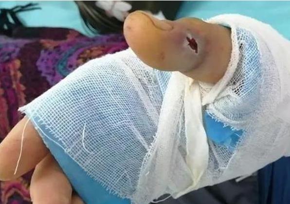 毒蛇泡酒一年,开瓶窜出咬人,为啥蛇还没死?