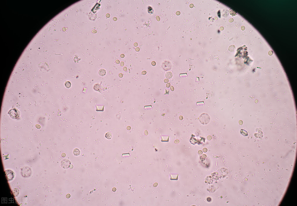 尿路感染,身体会出现什么症状?