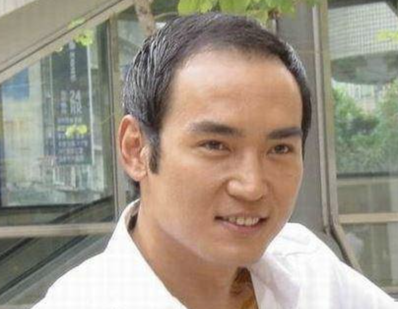 为此,焦恩俊只好把头发都往一侧梳,希望能够掩盖秃顶的问题,可是效果