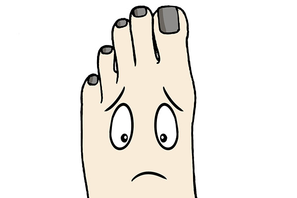 小脚趾指甲分成两瓣，是怎么回事？对健康有影响吗？告诉你答案