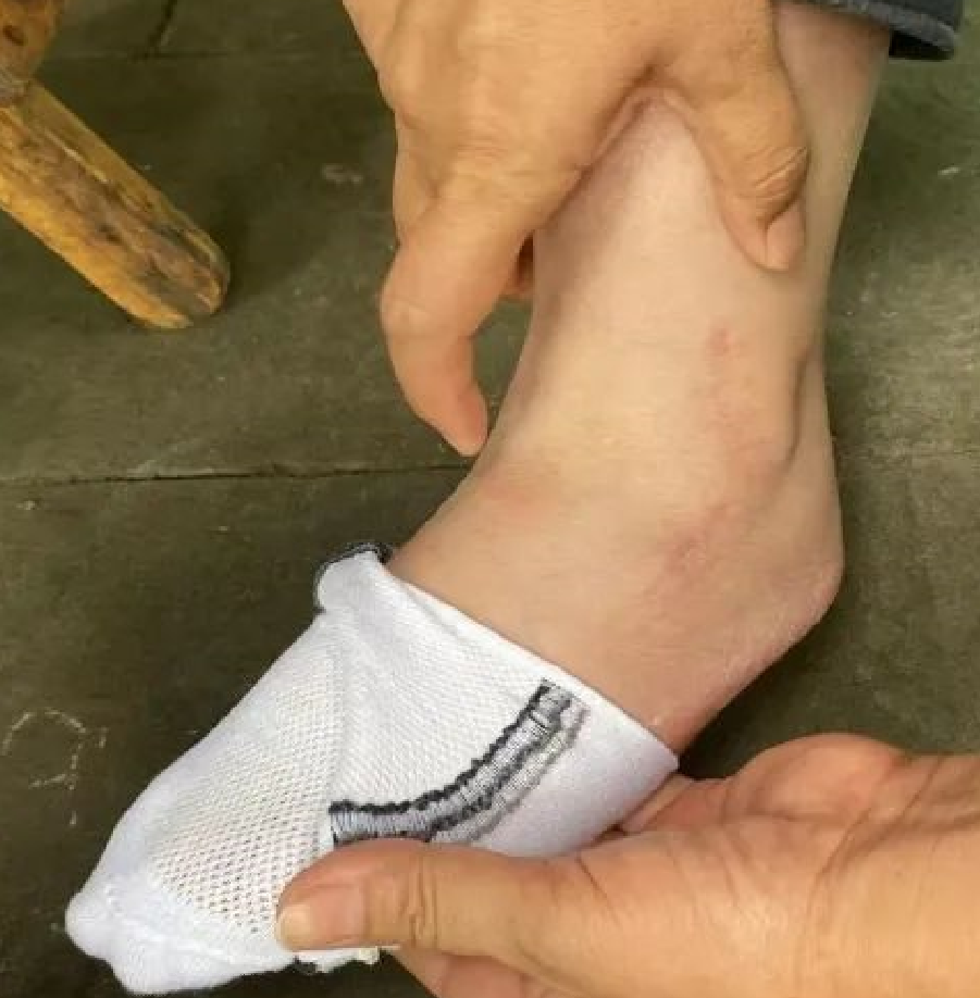 四川一“楼长”学姐查零食，13岁女生被罚150个下蹲，致终身残疾