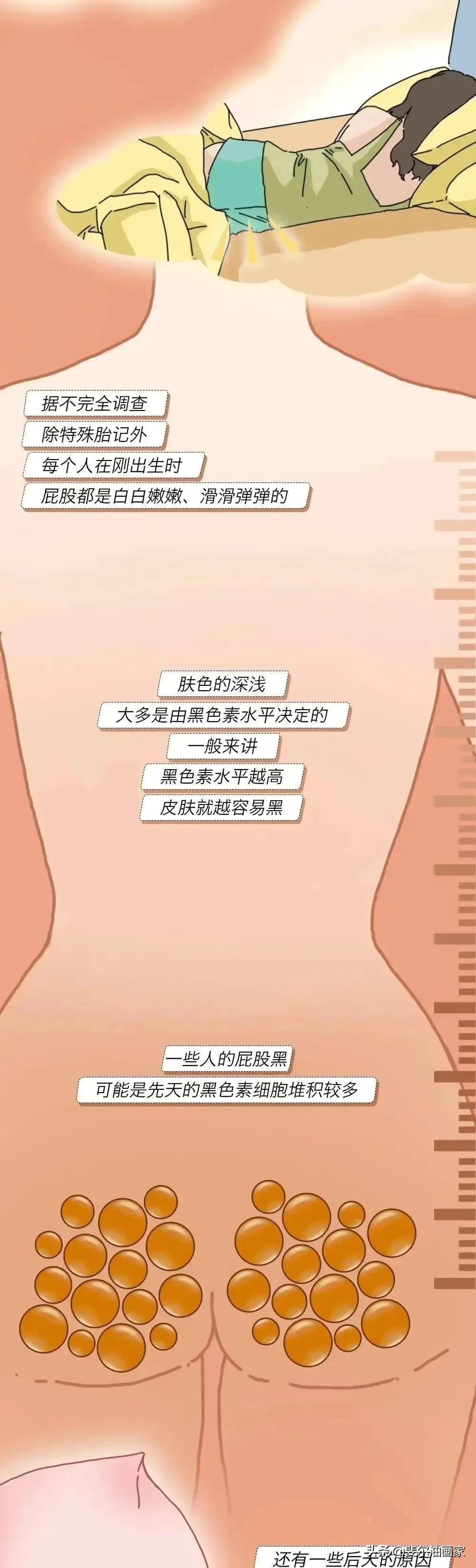 女生需要注意了，屁股变黑和变大是有原因的，漫画告诉你答案