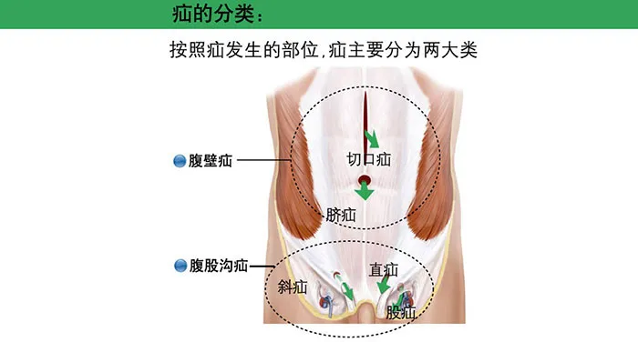 肠道“推粪机”公布，为何没有香蕉？这4种食物平时不妨多吃些