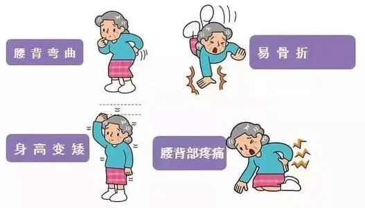 台州女子突然变矮5厘米!原因跟这个习惯有关,很多人都有!