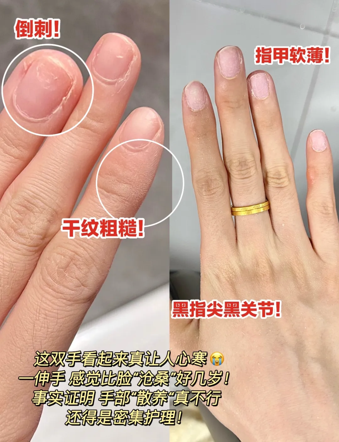 秋冬护手C位！栀诺护手霜，换季干燥 “一键舒缓”～