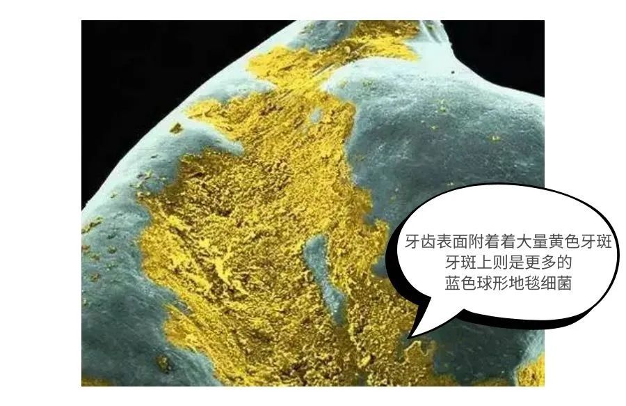 放大1000倍的牙齿太可怕了!看过你肯定会好好刷牙了