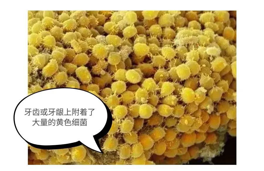 放大1000倍的牙齿太可怕了!看过你肯定会好好刷牙了