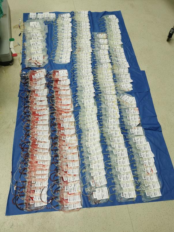 高龄产妇突发羊水栓塞,30余名医护27小时生死救援